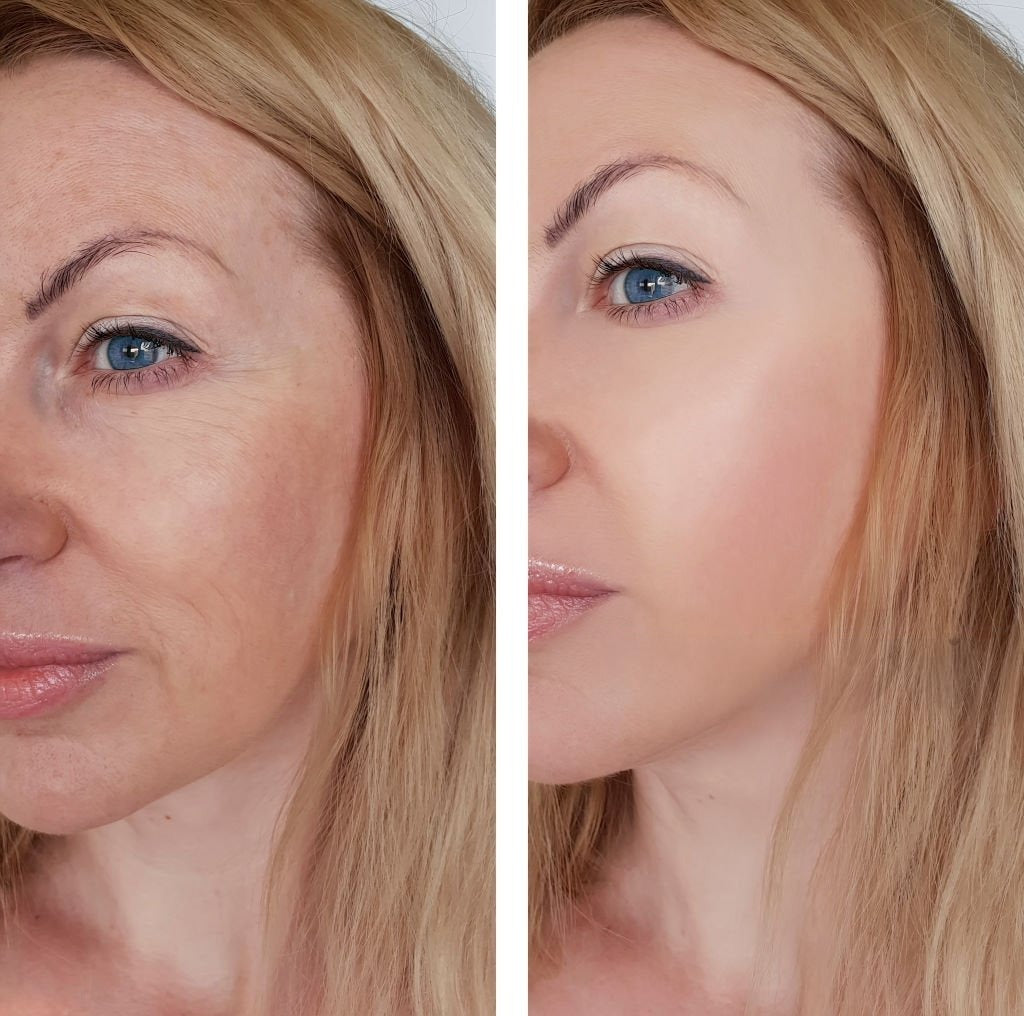 Peptide Anti-Aging Serum